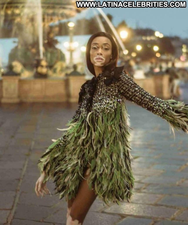 Winnie Harlow Harpers Bazaar  Celebrity Babe Magazine Paparazzi